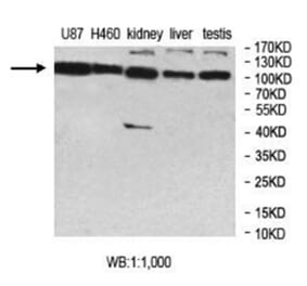 MCTP2 Antibody from Signalway Antibody (40015) - Antibodies.com