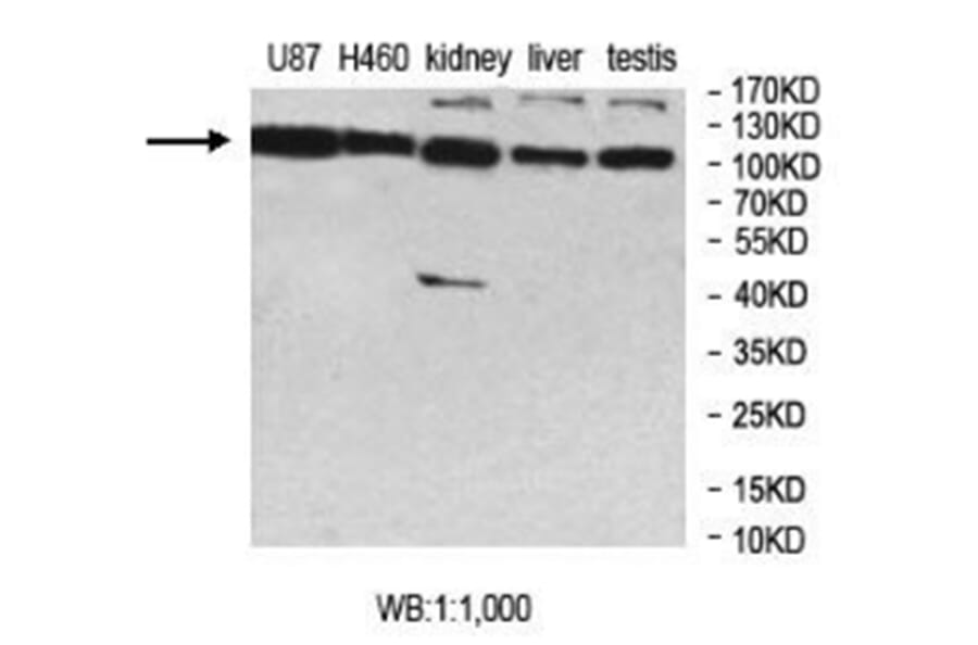 MCTP2 Antibody from Signalway Antibody (40015) - Antibodies.com