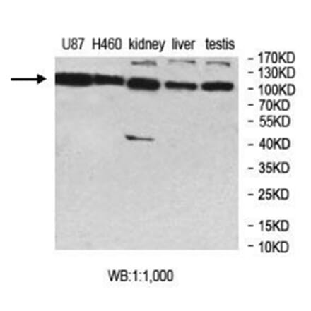 MCTP2 Antibody from Signalway Antibody (40015) - Antibodies.com