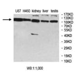 MCTP2 Antibody from Signalway Antibody (40015) - Antibodies.com