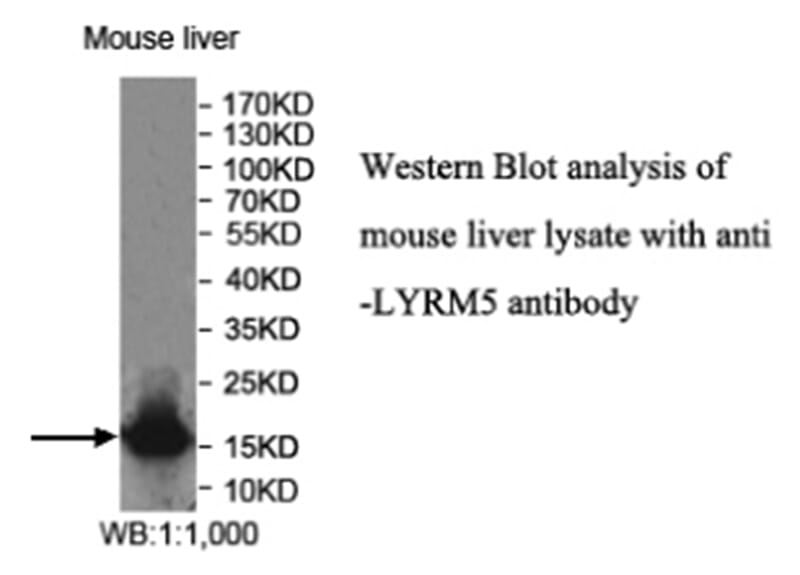 Anti-LYRM5 Antibody