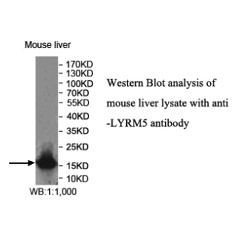 LYRM5 Antibody from Signalway Antibody (40017) - Antibodies.com