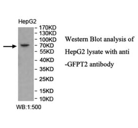 GFPT2 Antibody from Signalway Antibody (40023) - Antibodies.com