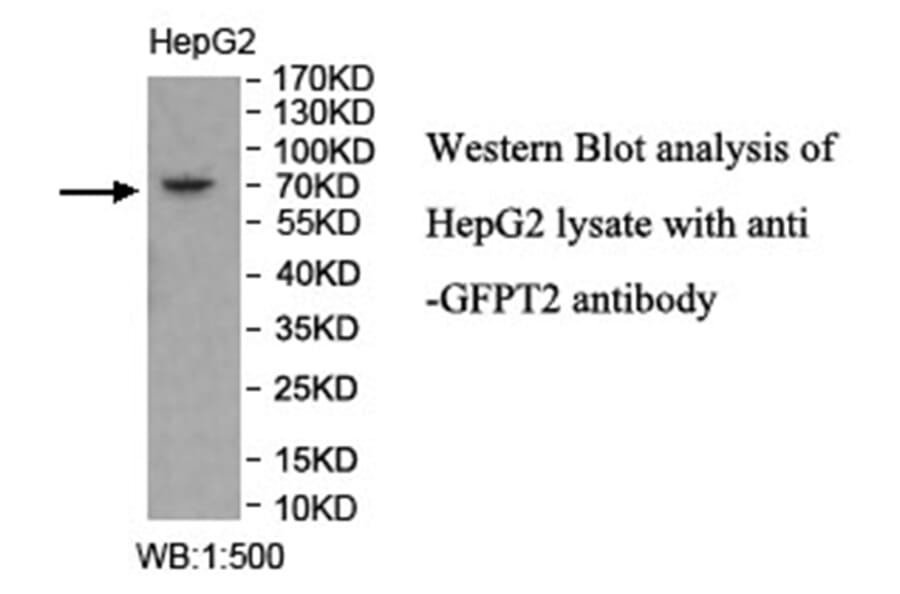 GFPT2 Antibody from Signalway Antibody (40023) - Antibodies.com