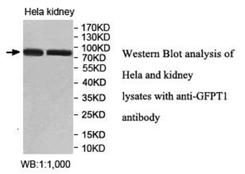 Anti-GFPT1 Antibody