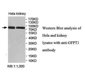 GFPT1 Antibody from Signalway Antibody (40024) - Antibodies.com