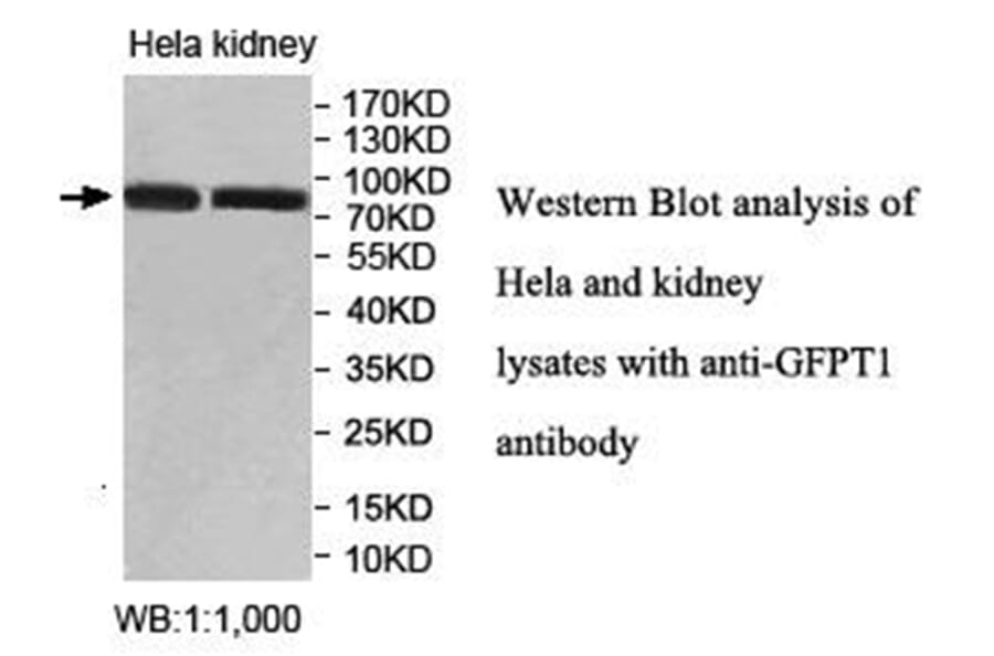 GFPT1 Antibody from Signalway Antibody (40024) - Antibodies.com