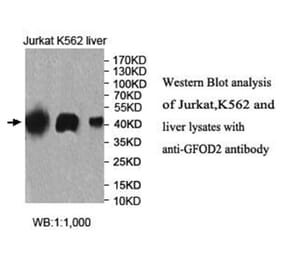 GFOD2 Antibody from Signalway Antibody (40026) - Antibodies.com