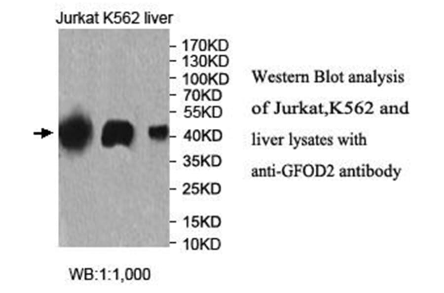 GFOD2 Antibody from Signalway Antibody (40026) - Antibodies.com