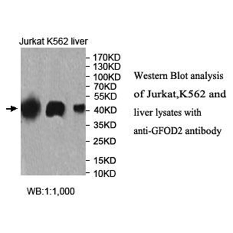 GFOD2 Antibody from Signalway Antibody (40026) - Antibodies.com