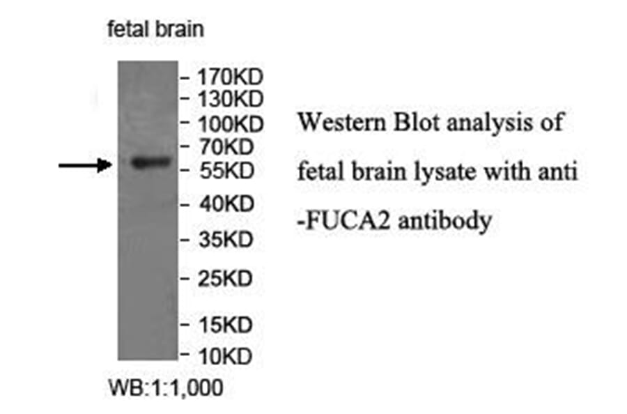 FUCA2 Antibody from Signalway Antibody (40034) - Antibodies.com