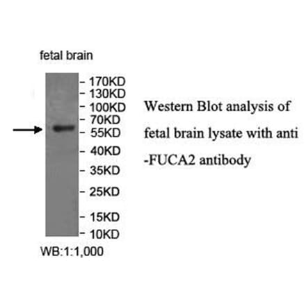 FUCA2 Antibody from Signalway Antibody (40034) - Antibodies.com