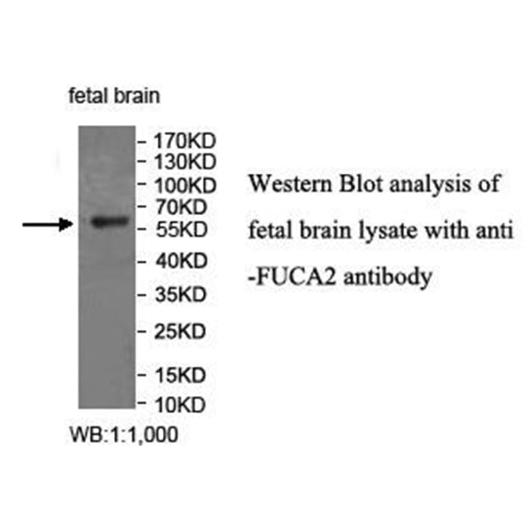 FUCA2 Antibody from Signalway Antibody (40034) - Antibodies.com