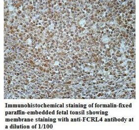 FCRL4 Antibody from Signalway Antibody (40042) - Antibodies.com