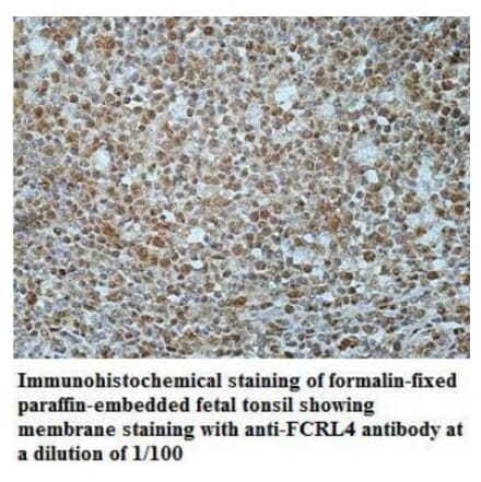 FCRL4 Antibody from Signalway Antibody (40042) - Antibodies.com