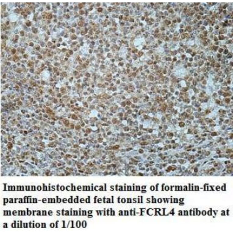 FCRL4 Antibody from Signalway Antibody (40042) - Antibodies.com