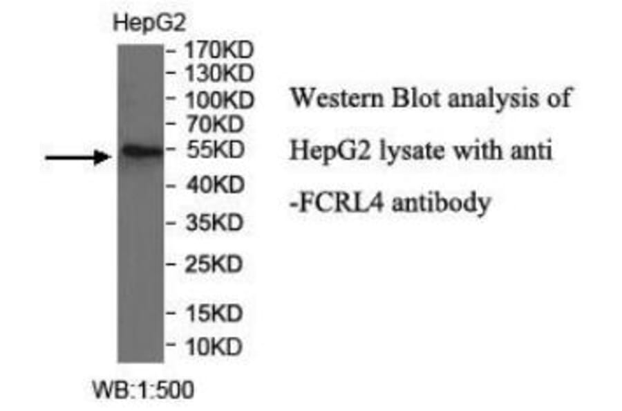 FCRL4 Antibody from Signalway Antibody (40042) - Antibodies.com