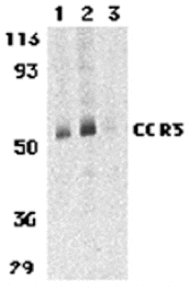 Western blot - CCR3 Antibody from Signalway Antibody (24005) - Antibodies.com