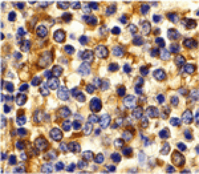 Immunohistochemistry - CCR3 Antibody from Signalway Antibody (24005) - Antibodies.com
