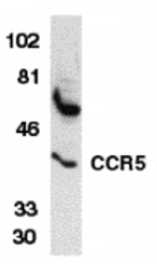 Western blot - CCR5 Antibody from Signalway Antibody (24008) - Antibodies.com