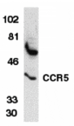Western blot - CCR5 Antibody from Signalway Antibody (24008) - Antibodies.com