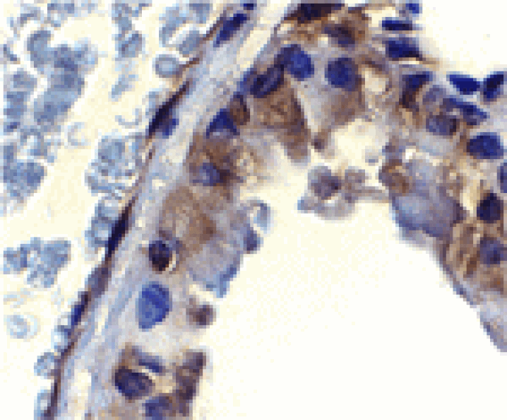 Immunohistochemistry - ICAD Antibody from Signalway Antibody (24035) - Antibodies.com