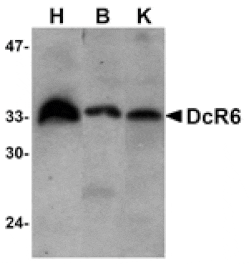 Western blot - DcR3 Antibody from Signalway Antibody (24071) - Antibodies.com