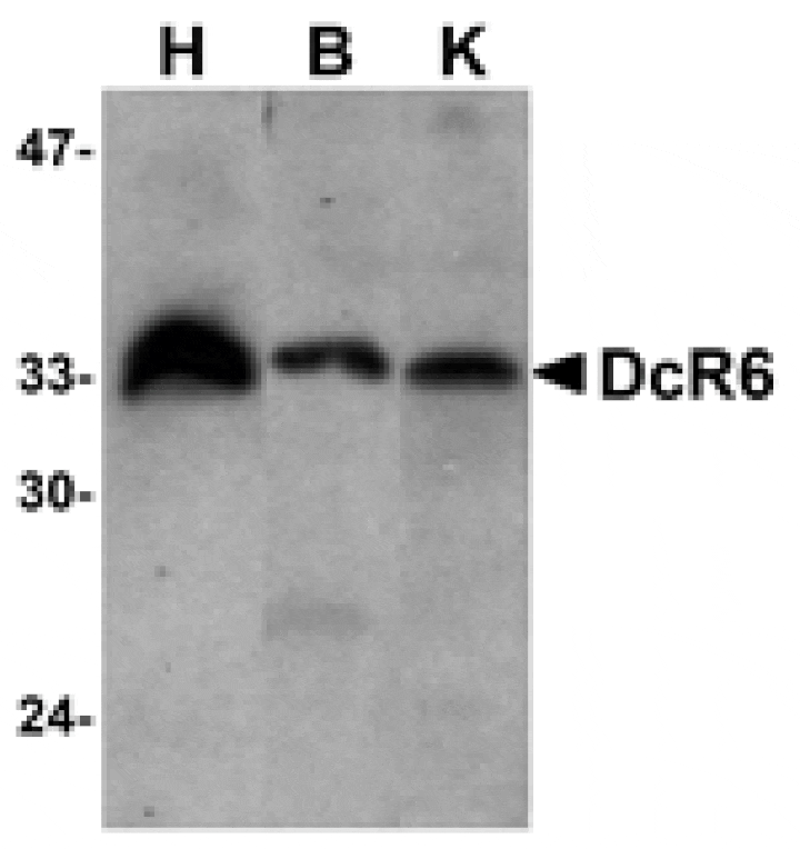 Western blot - DcR3 Antibody from Signalway Antibody (24071) - Antibodies.com