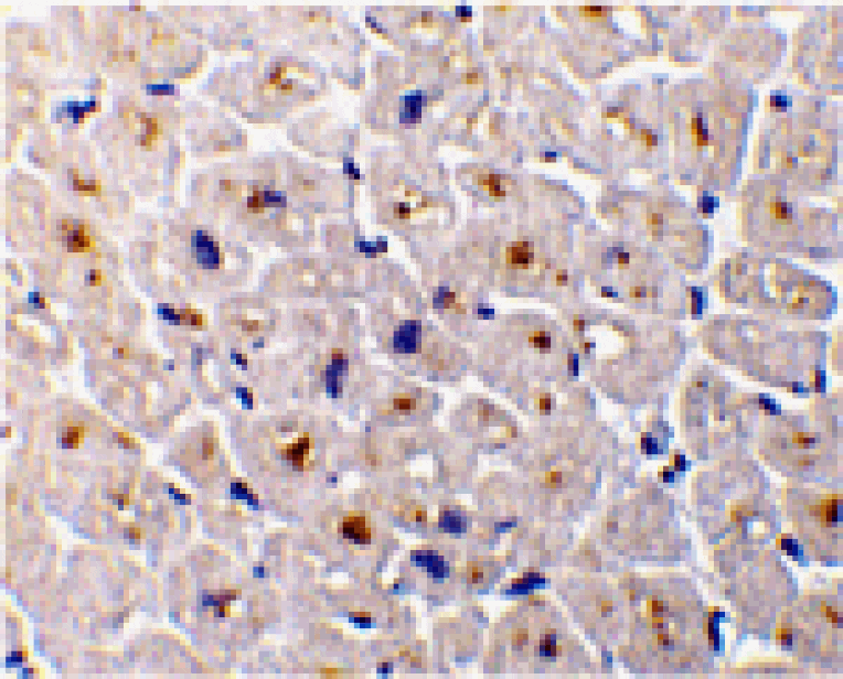 Immunohistochemistry - DcR3 Antibody from Signalway Antibody (24071) - Antibodies.com