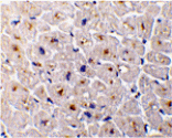 Immunohistochemistry - DcR3 Antibody from Signalway Antibody (24071) - Antibodies.com