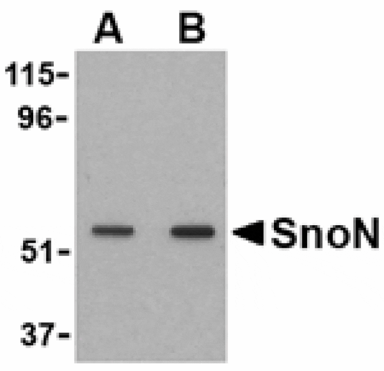 Western blot - SnoN Antibody from Signalway Antibody (24101) - Antibodies.com