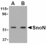 Western blot - SnoN Antibody from Signalway Antibody (24101) - Antibodies.com