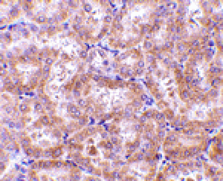 Immunohistochemistry - RIP3 Antibody from Signalway Antibody (24109) - Antibodies.com