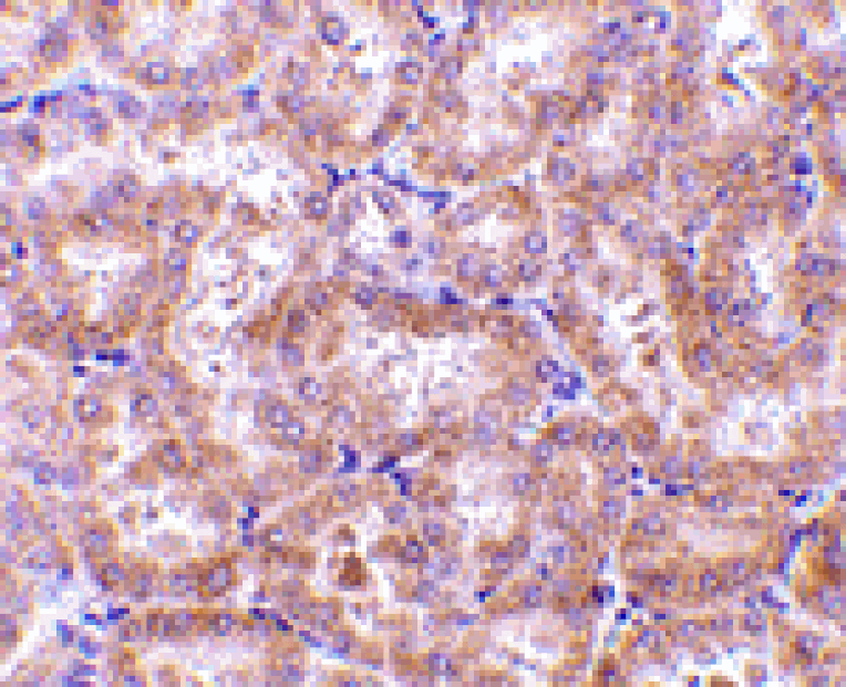 Immunohistochemistry - RIP3 Antibody from Signalway Antibody (24109) - Antibodies.com