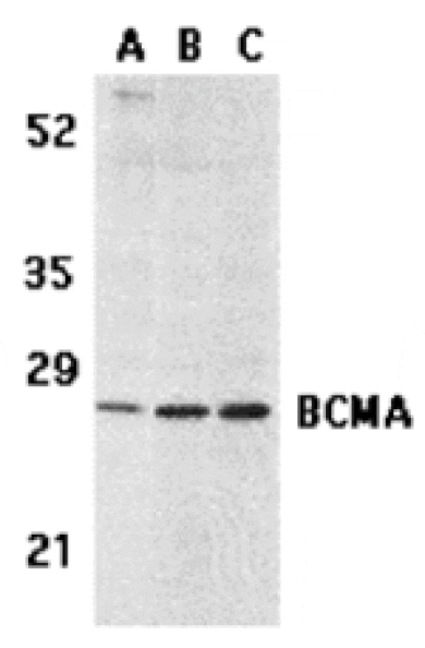 Western blot - BCMA Antibody from Signalway Antibody (24132) - Antibodies.com