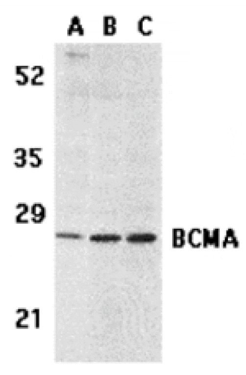 Western blot - BCMA Antibody from Signalway Antibody (24132) - Antibodies.com