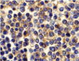 Immunohistochemistry - BCMA Antibody from Signalway Antibody (24132) - Antibodies.com