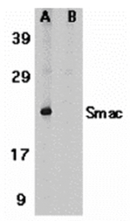Western blot - Smac Antibody from Signalway Antibody (24133) - Antibodies.com