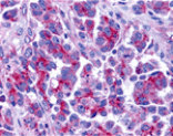Immunohistochemistry - Smac Antibody from Signalway Antibody (24133) - Antibodies.com