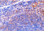 Immunohistochemistry - Smac Antibody from Signalway Antibody (24134) - Antibodies.com