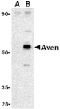Western blot - Aven Antibody from Signalway Antibody (24135) - Antibodies.com