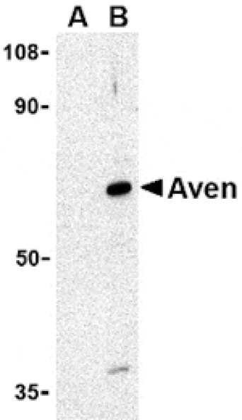Western blot - Aven Antibody from Signalway Antibody (24137) - Antibodies.com