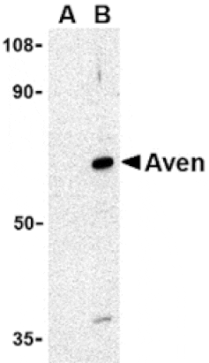 Western blot - Aven Antibody from Signalway Antibody (24137) - Antibodies.com