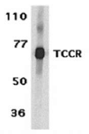 Western blot - TCCR Antibody from Signalway Antibody (24147) - Antibodies.com