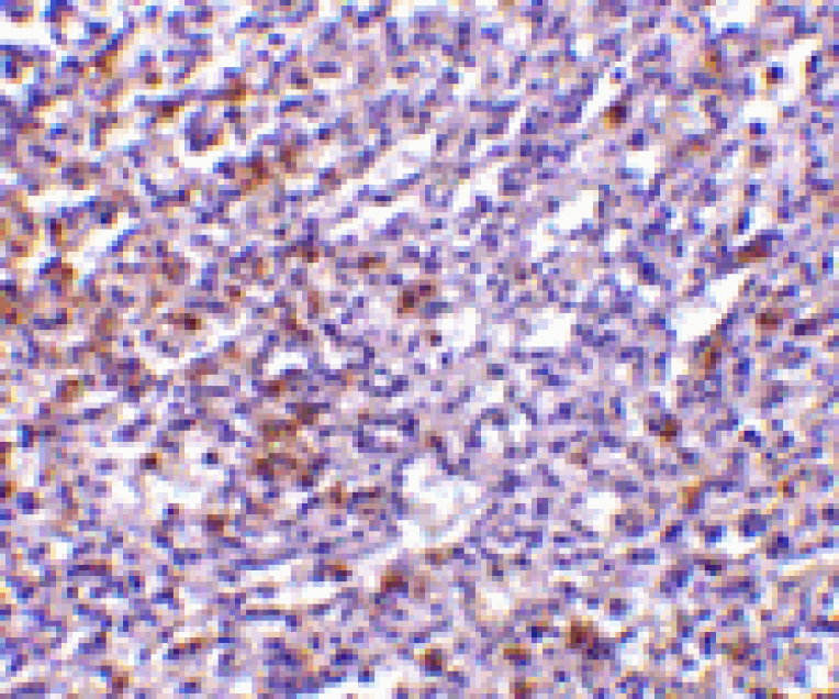 Immunohistochemistry - TCCR Antibody from Signalway Antibody (24147) - Antibodies.com