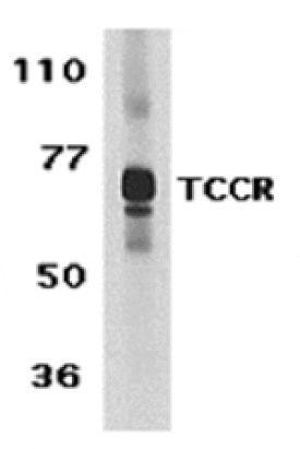 Western blot - TCCR Antibody from Signalway Antibody (24148) - Antibodies.com