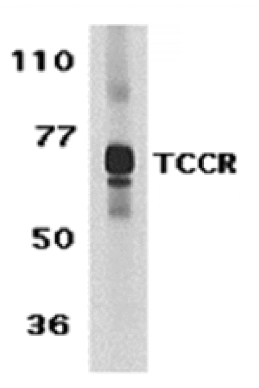 Western blot - TCCR Antibody from Signalway Antibody (24148) - Antibodies.com