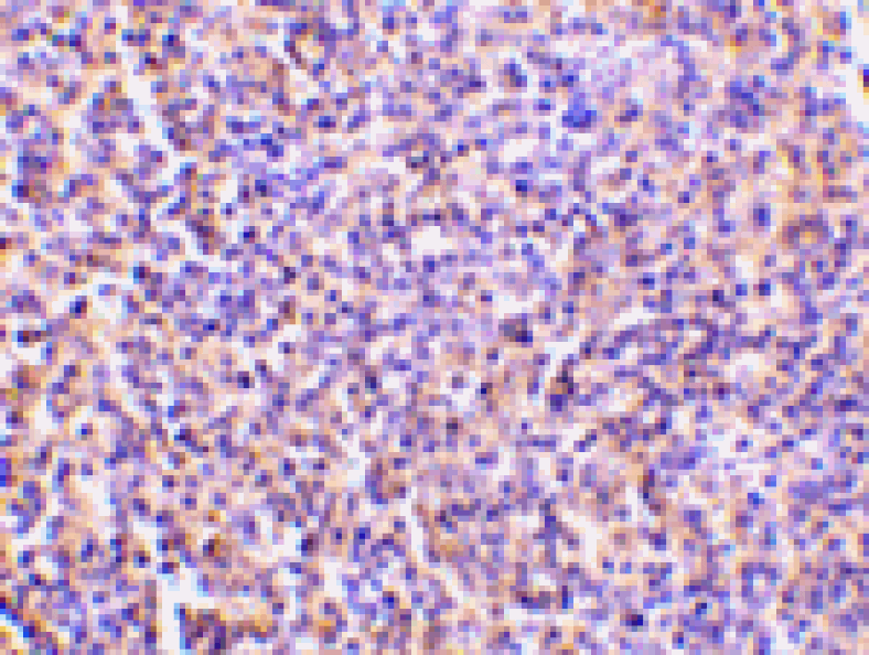Immunohistochemistry - TCCR Antibody from Signalway Antibody (24148) - Antibodies.com
