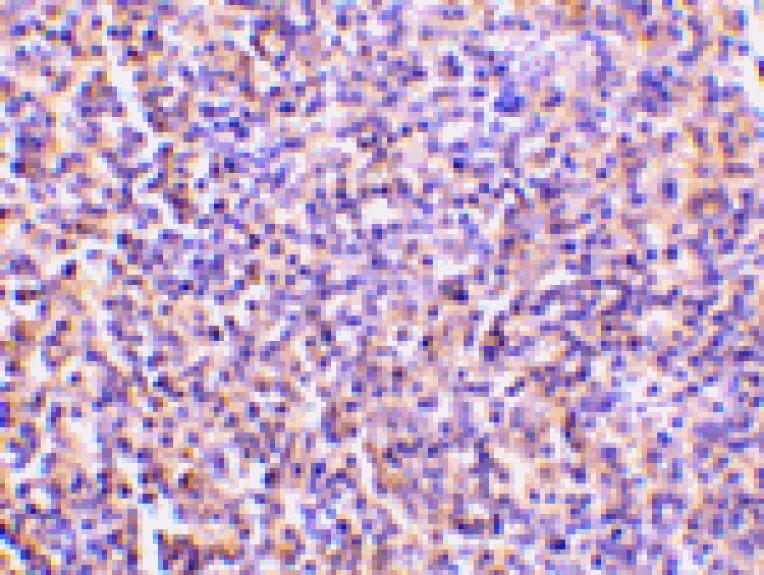 Immunohistochemistry - TCCR Antibody from Signalway Antibody (24148) - Antibodies.com