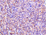 Immunohistochemistry - TCCR Antibody from Signalway Antibody (24148) - Antibodies.com